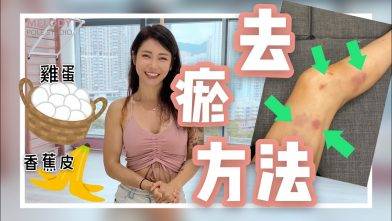 跳鋼鋼管舞的小知識【去瘀方法】